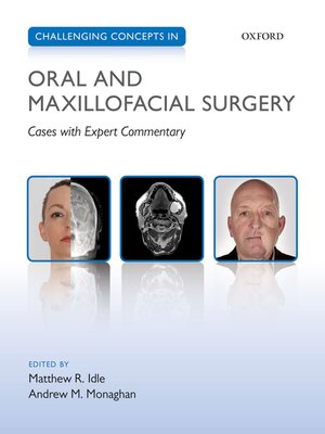 cover image of Challenging Concepts in Oral and Maxillofacial Surgery